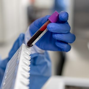 Close-up on a technician analyzing blood samples at the lab and holding a test tube - healthcare and medicine